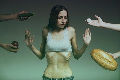 Девушка с анорексией